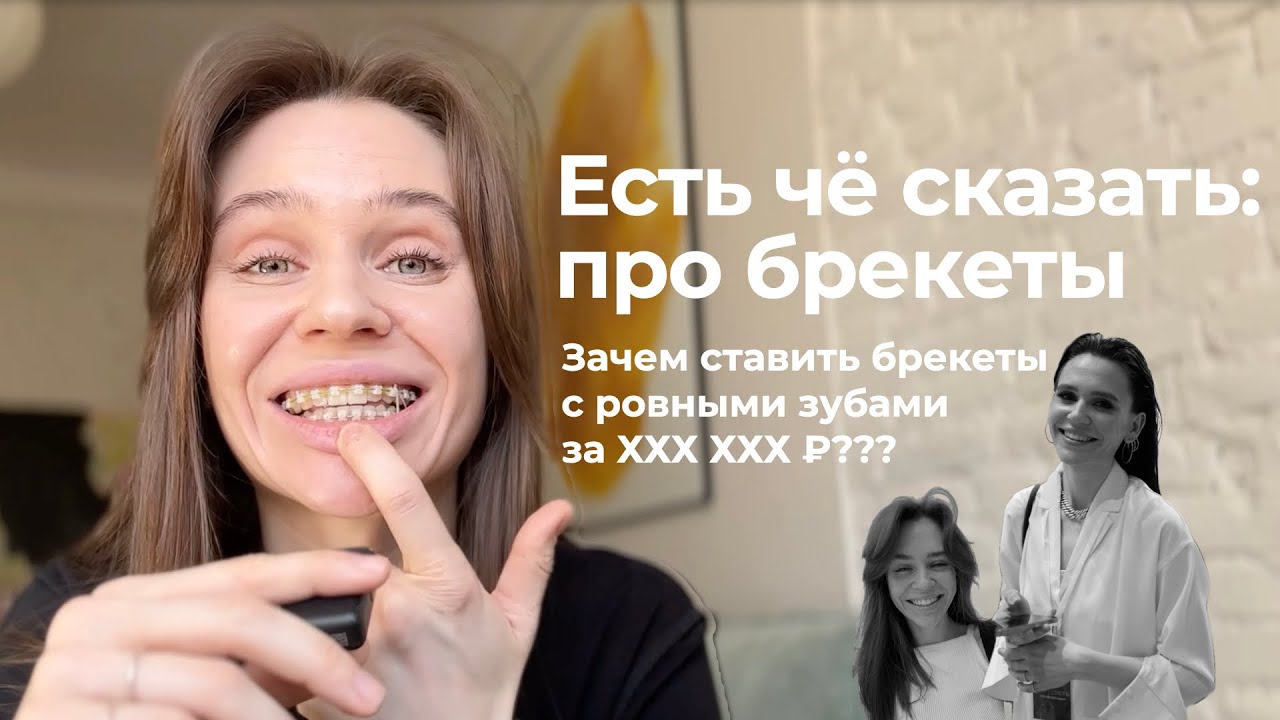 УЛЫБКА НА МИЛЛИОН | Брекеты: сколько стоят брекеты, как устанавливают и почему не элайнеры?