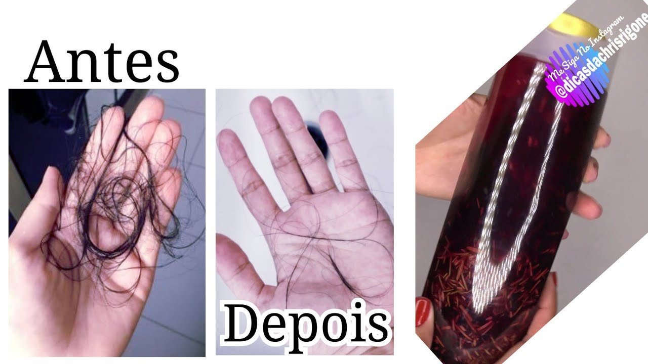 SHAMPOO BOMBA QUE  VAI FAZER SEU CABELO  CRESCER MUITO R&Aacute;PIDO  E PARAR DE CAIR