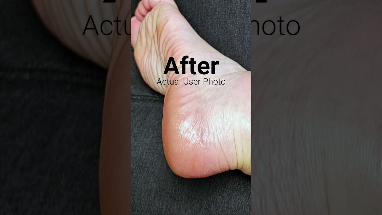 Powerful Natural Healing Compounds for Foot Health! 