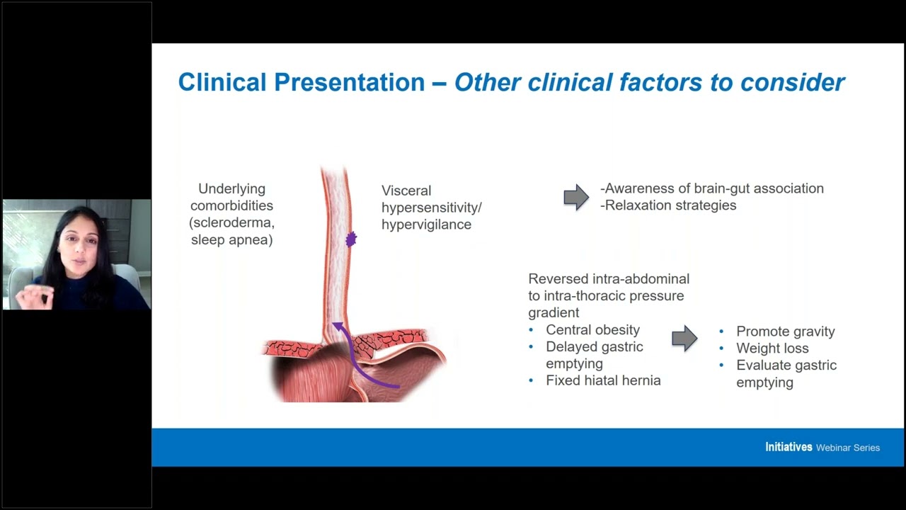 State of the Art on the Evaluation and Management of Gastroesophageal Reflux Disease