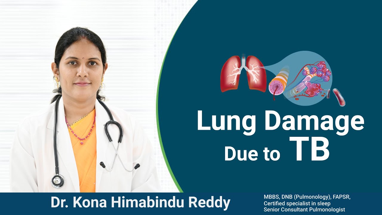 Lung Damage Due to TB last for life time | Dr. Konda Hima Bindu Reddy, Senior Pulmonologist | KPHB