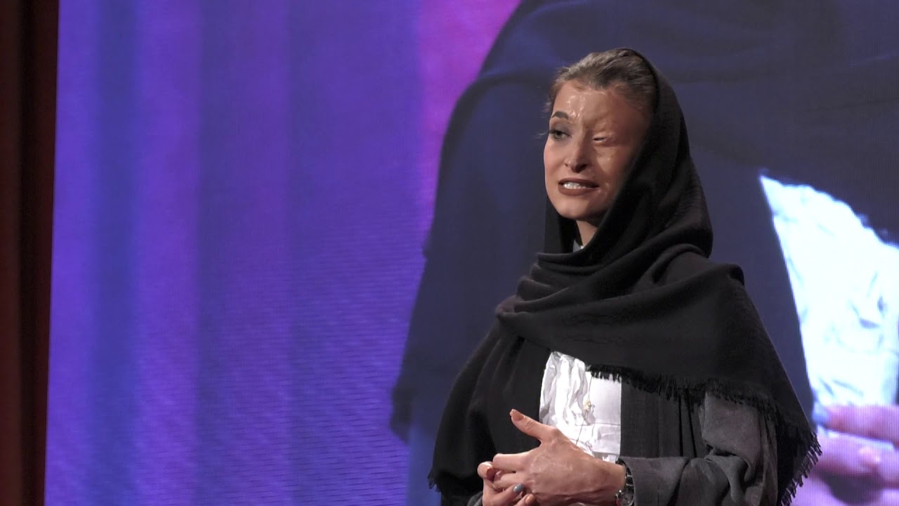 A very abnormal view of violence and what we can do | Marzieh Ebrahimi | TEDxAmirkabirUniversity