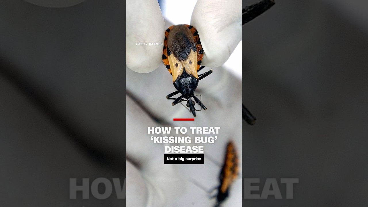 How to diagnosis and treat &lsquo;kissing bug&rsquo; disease