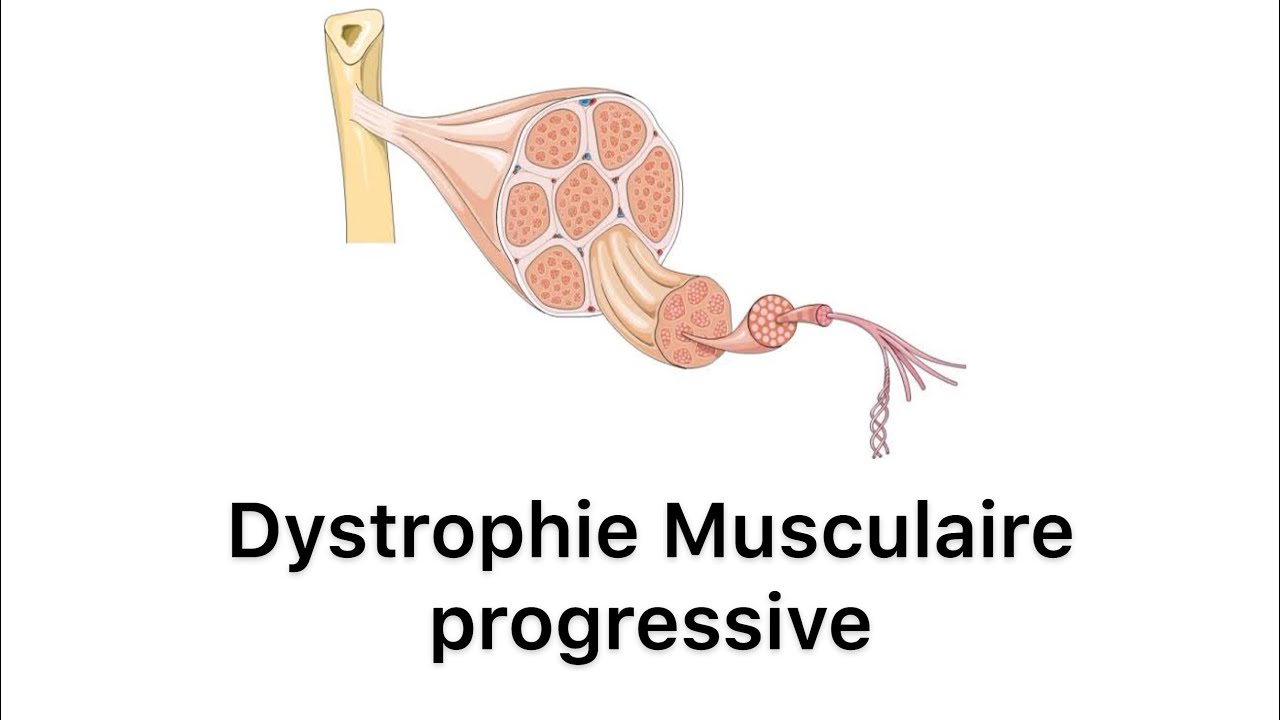 🔻 Dystrophie musculaire Progressive part one  | Neurologie | 4ème année