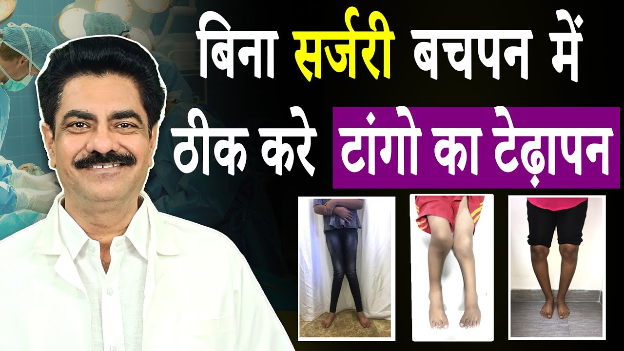 Worried about knock knee in your child? Watch This! | Arthritis | Longlivelives Hindi