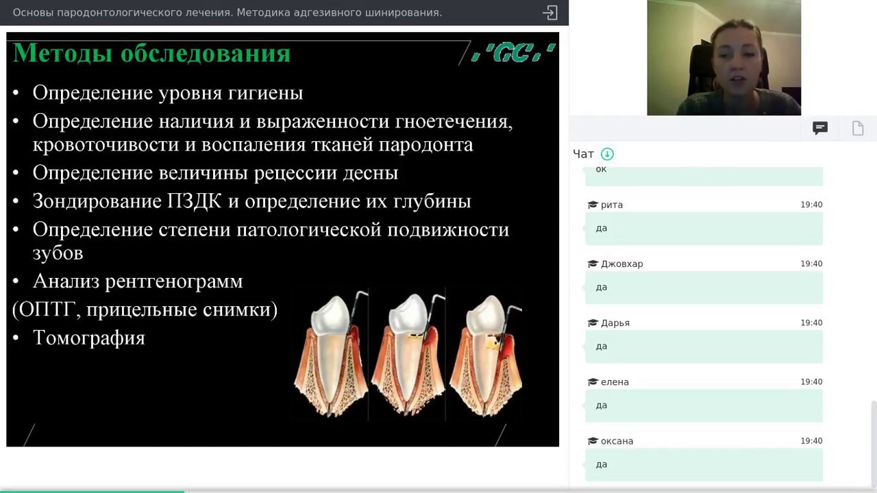 Адгезивное шинирование.  Основы пародонтологического лечения (Вебинар от 17.11.17)