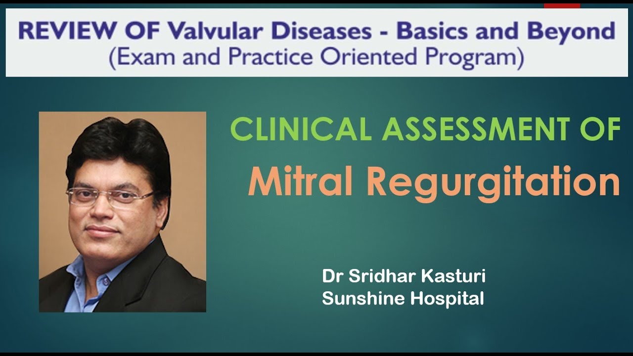 Clinical assessment of Mitral Regurgitation Dr Guru Chaithanya
