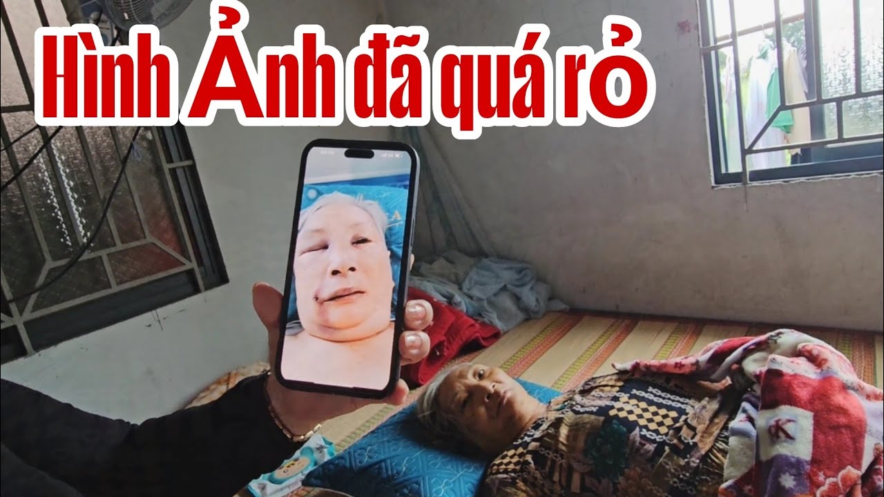 Hình ảnh đã quá rỏ ràng.