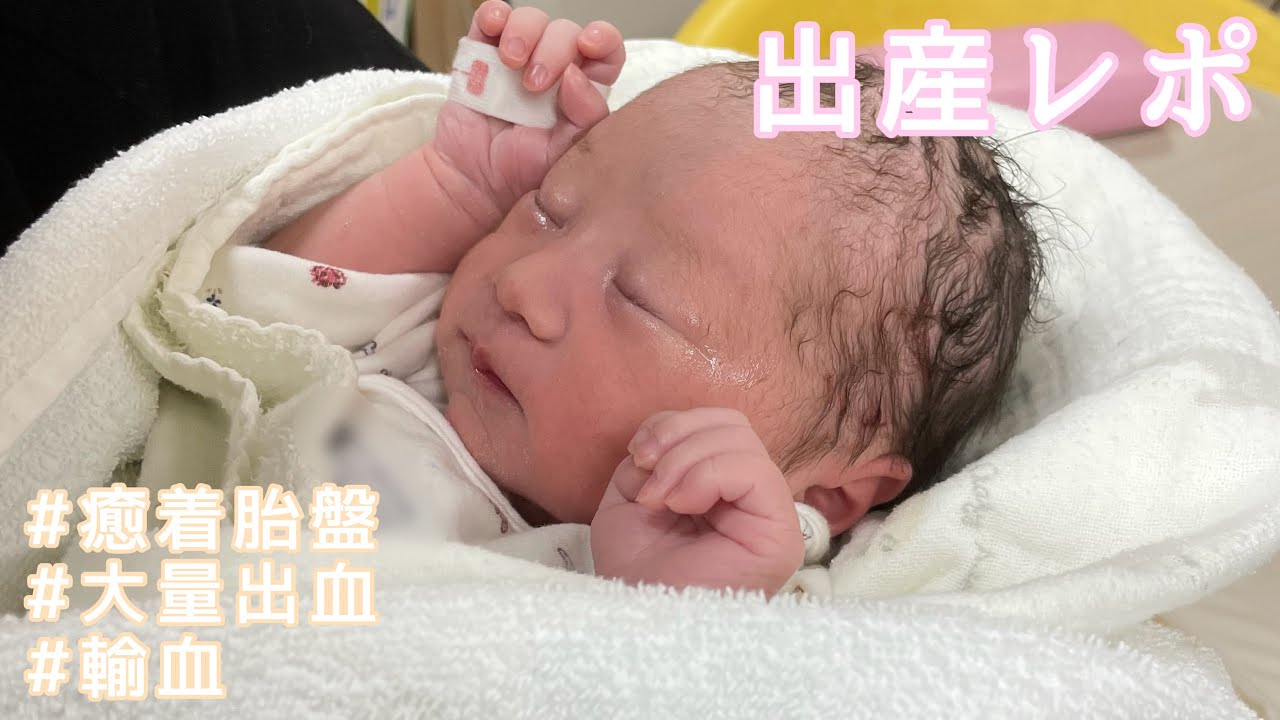 【出産レポ】陣痛・出産の何倍も辛かった産後処置￤癒着胎盤で2,300mlの大量出血で輸血に