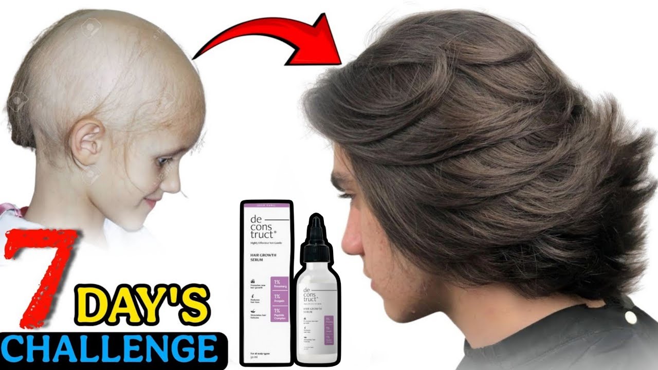 Hair Serum After 15 Days Review | Best Hair Growth Serum For Thin Hair in India 2025 ! EP 8768