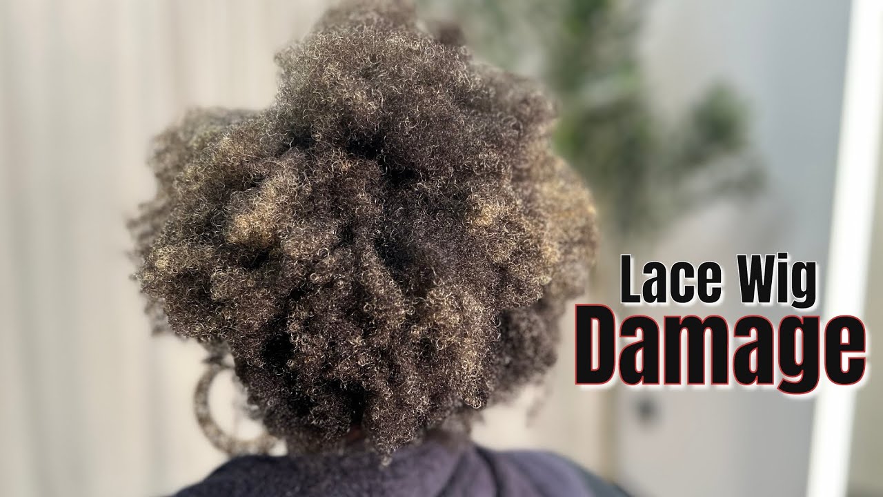 She Lost Her Edges to Lace Fronts … Watch the Transformation 
