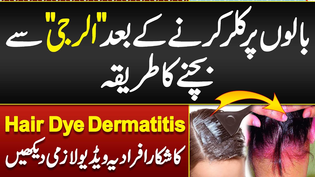 Hair Color Sy Allergy Ka ilaj- Hair Dye Dermatitis- Hair Dye Reactions- Hair Color Allergy Treatment