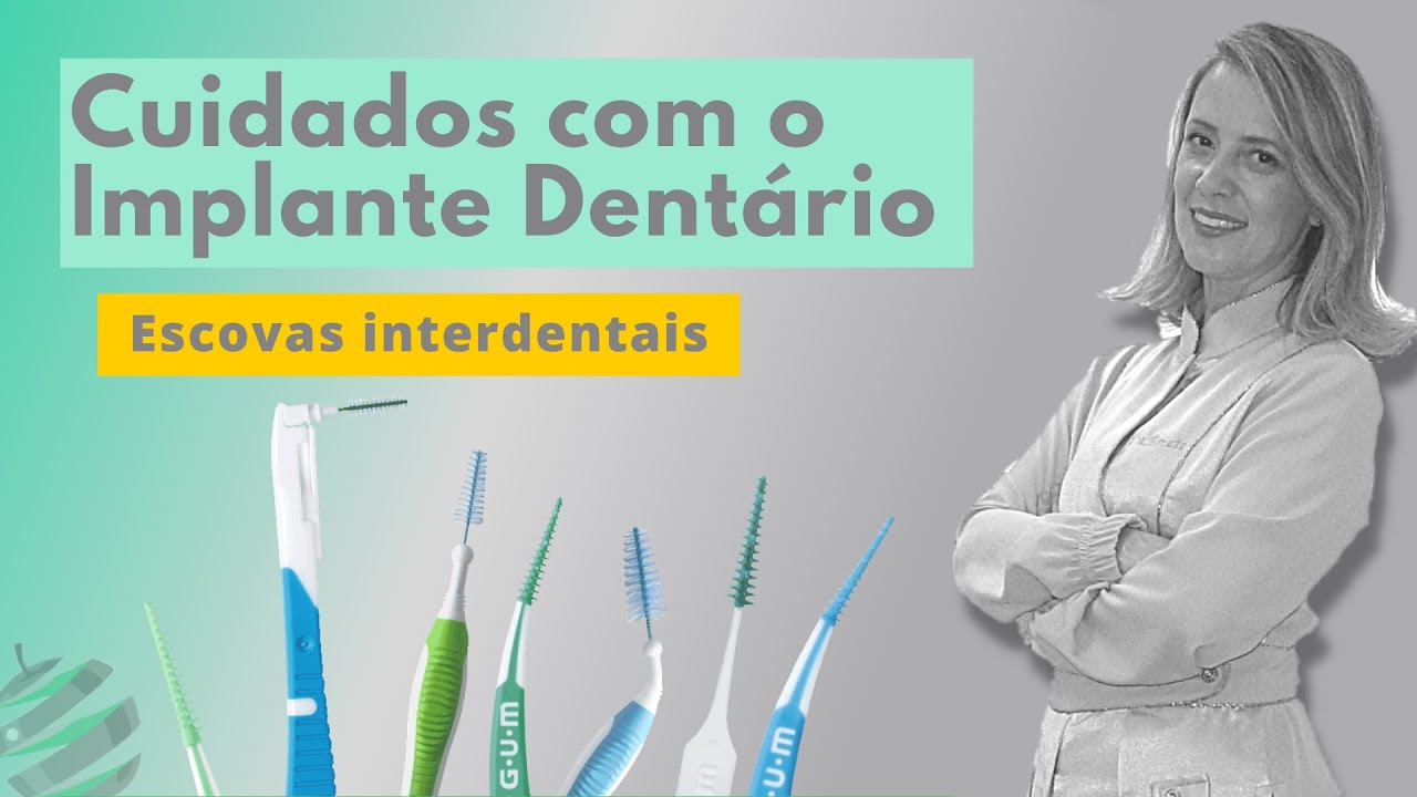 Cuidados com os Implantes Dentários - Escovas Interdentais