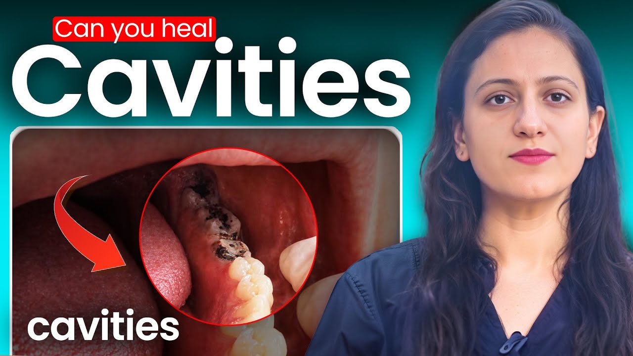 🦷 Can Cavities Really Heal on Their Own? | Dr. Reema