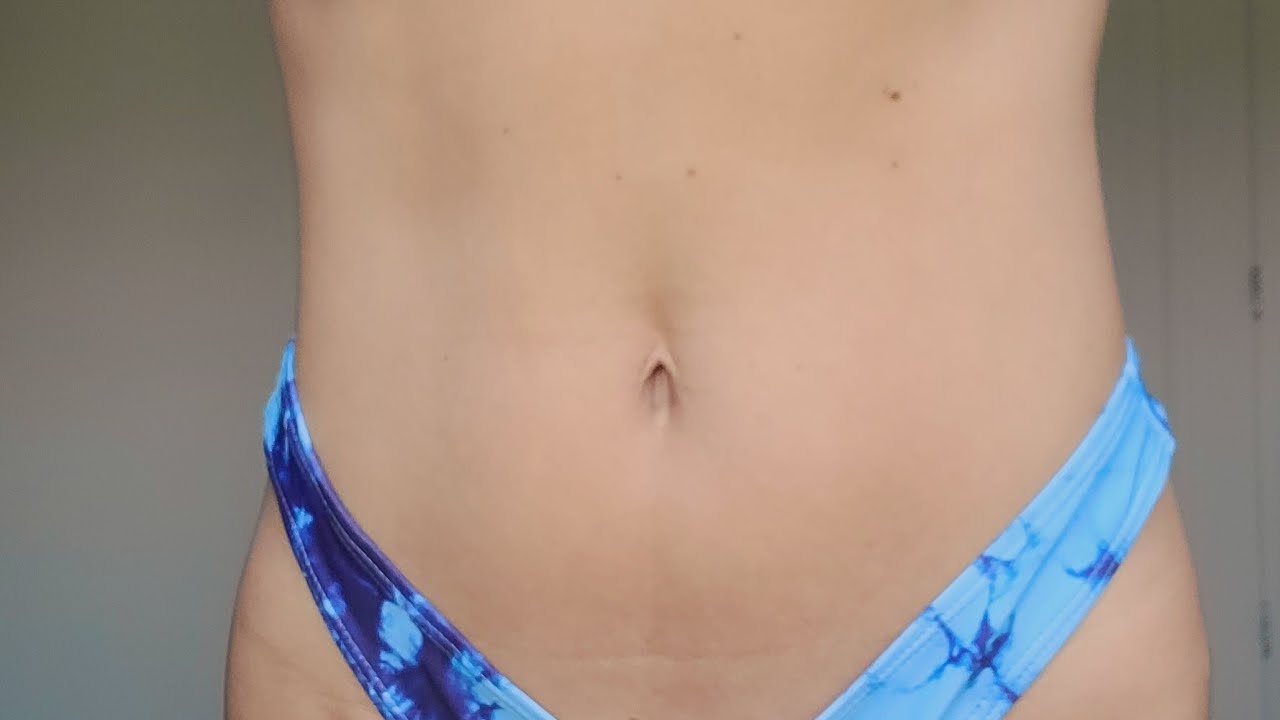 REDUZIR A BARRIGA!