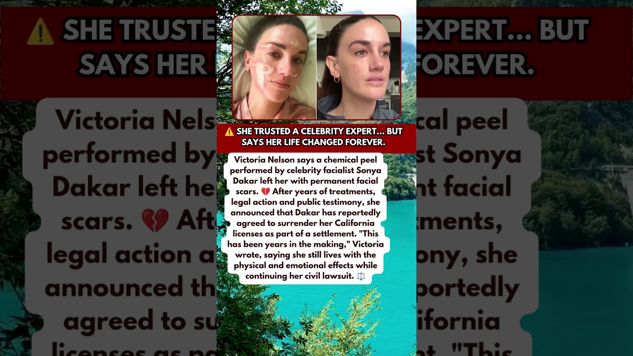 😳 Celebrity Facialist Loses License After Shocking Skin Damage Case