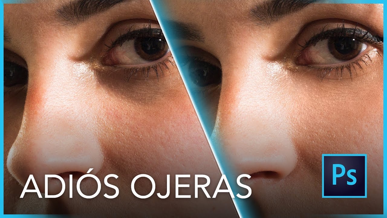 Quitar las OJERAS Fácil - Andreas López