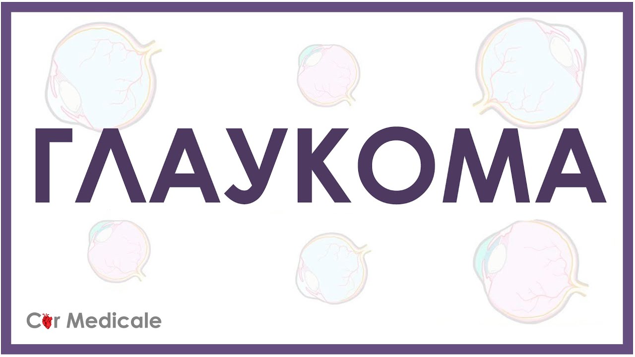 Глаукома - что такое, причины и симптомы