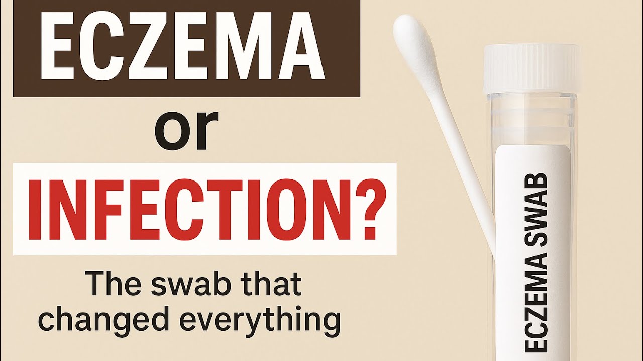 Eczema or Infection? The Swab That Gave Us Hope