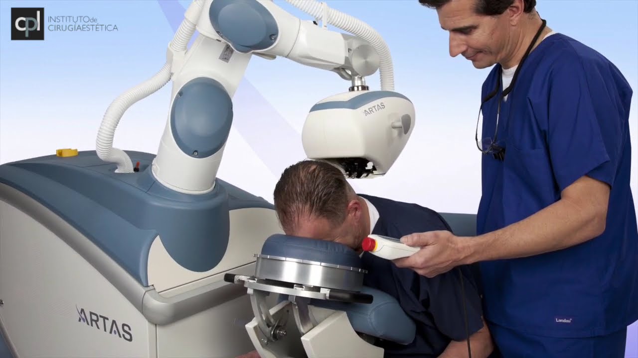 Implante capilar con robot Artas