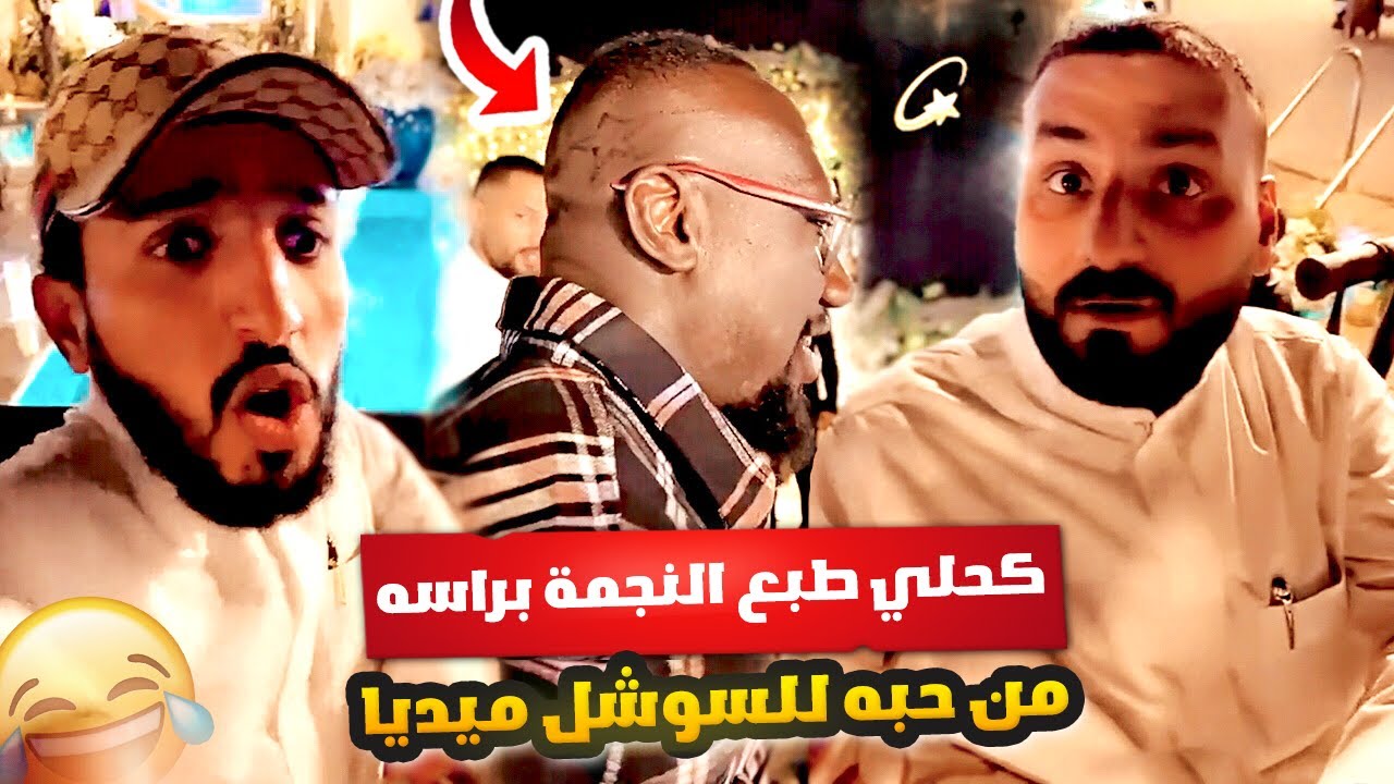 كحلي طبع النجمة في راسه من حبه للسوشل ميديا ⭐🤣