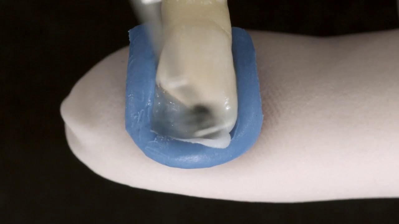 Tetric N Line (Ivoclar Vivadent)