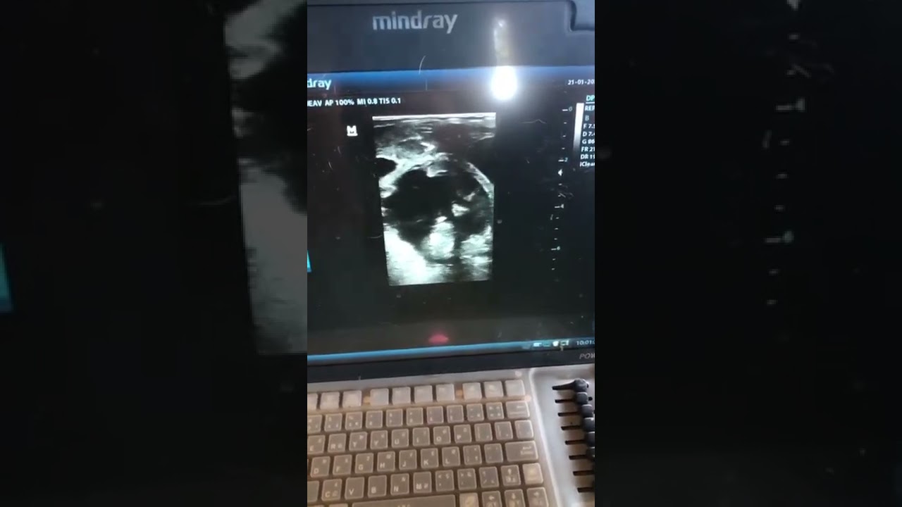 Ultrassom para Diagn&oacute;stico de prenhez em Ovinos