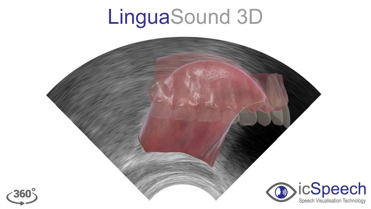 Ultrasound Tongue Imaging (UTI)