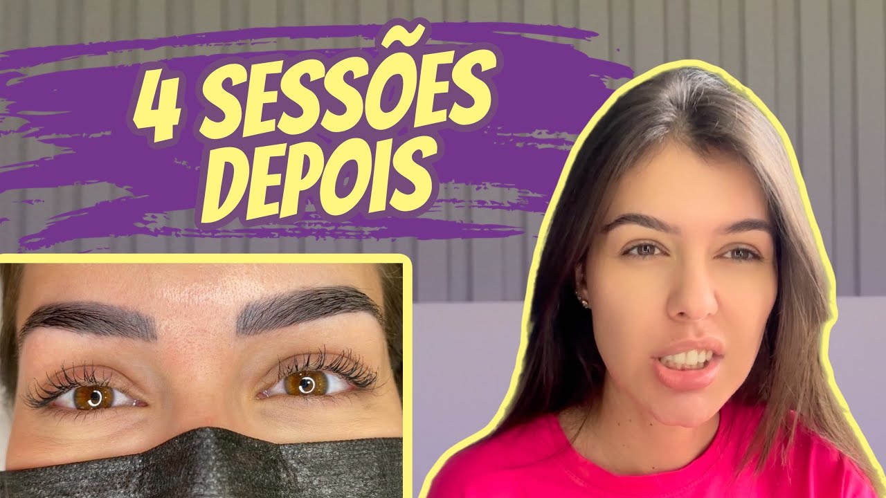 DESPIGMENTAÇÃO DE SOBRANCELHA MINHA EXPERIÊNCIA | ANTES E DEPOIS