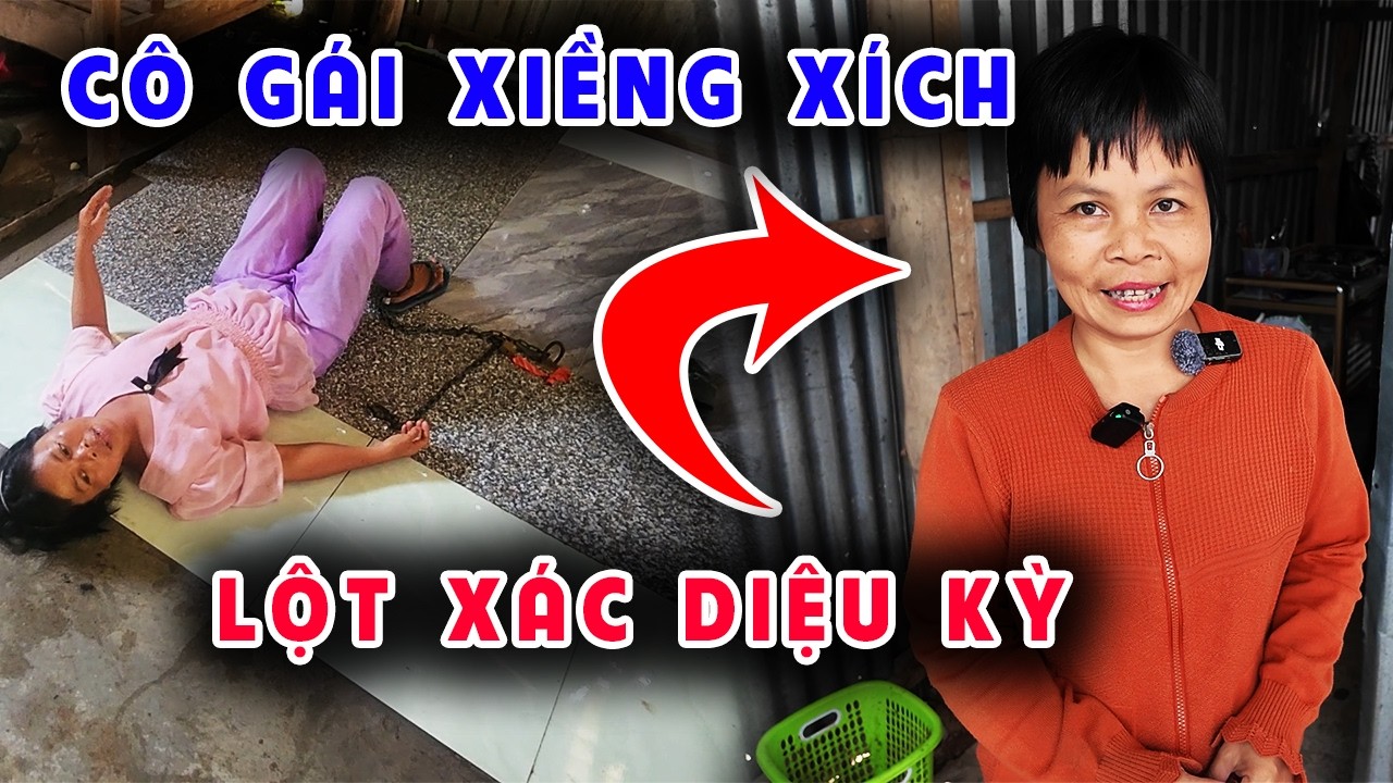 Kỳ tích cô gái xiềng xích bỗng thoát 