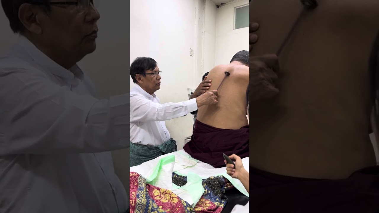 ရေအိမ်အတက်မှာလဲကျပြီး အောက်ပိုင်းမလှုပ်ရှားဆေးရုံမှာမထူးခြားလို့ဆင်းလာတဲ့ သက္ကလဆရာတော်ကြီး။