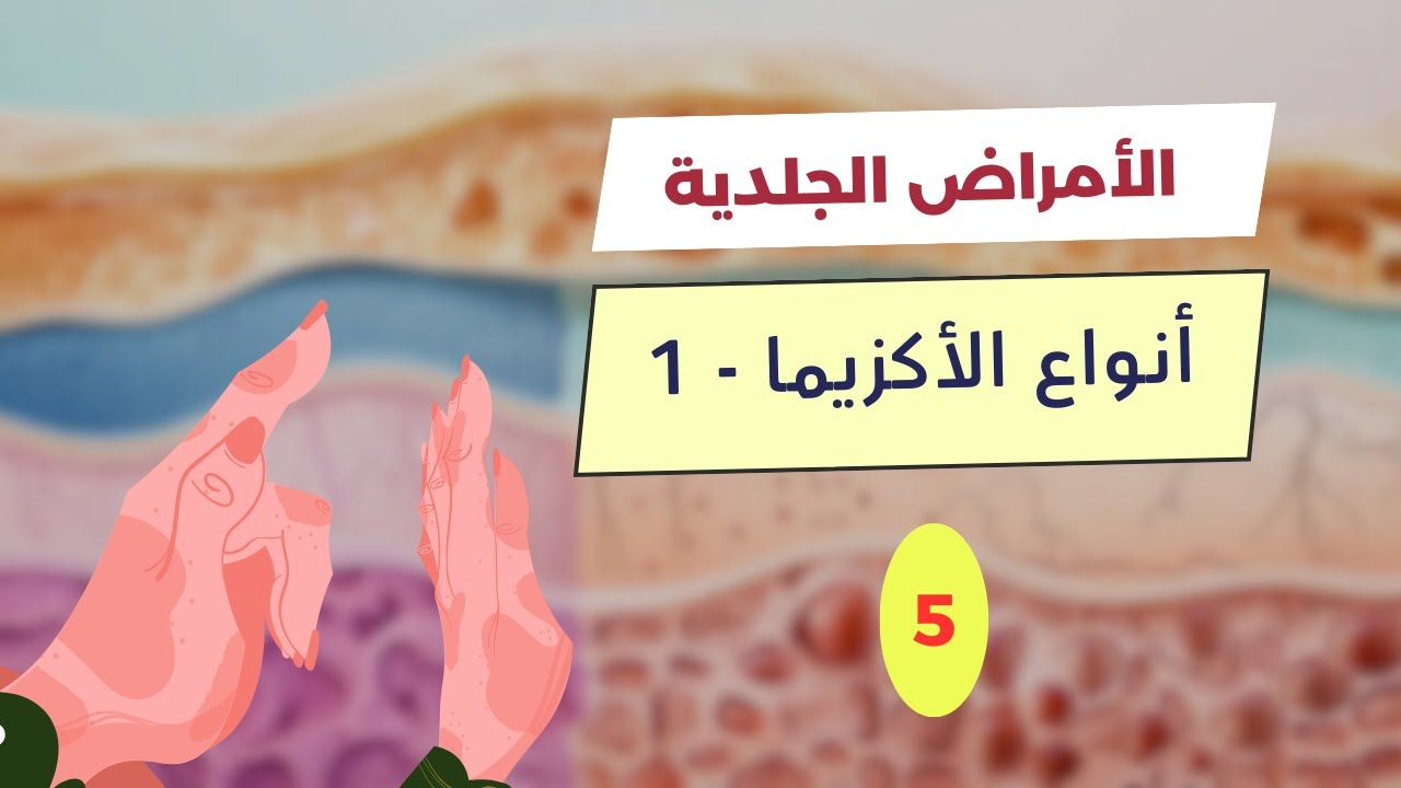 الدرس 5 | شرح صور شامل لأنواع الأكزيما – Complete Overview of Eczema Types