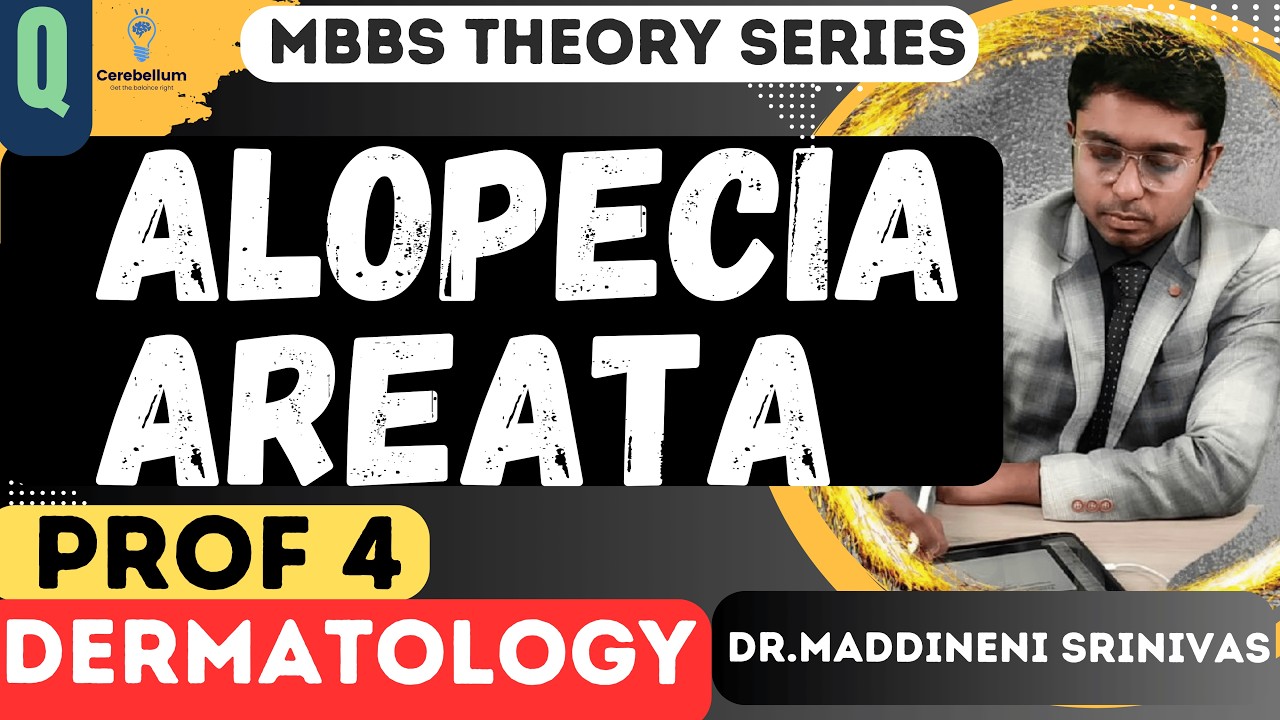 ALOPECIA AREATA | Dermatology for 4th year MBBS | SKIN Theory Question | Dr Maddineni Srinivas