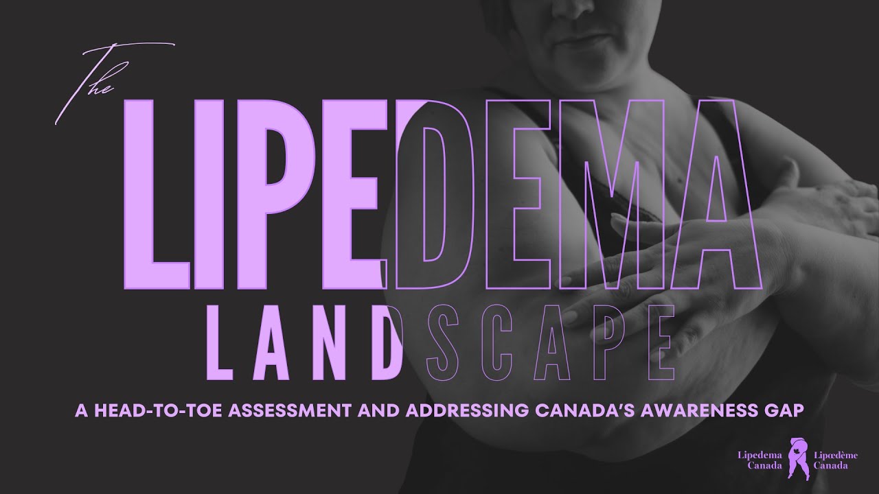 The Lipedema Landscape – A Head to Toe Assessment and Addressing Canada’s Awareness Gap