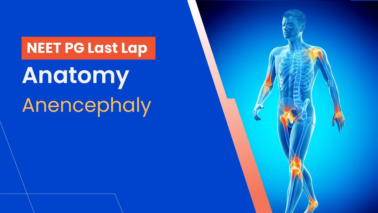 Anatomy - Anencephaly