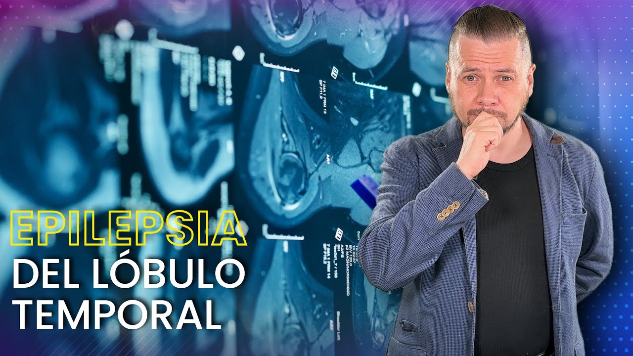 ¡Epilepsia del lóbulo frontal: Síntomas y tratamiento! 🧠⚡
