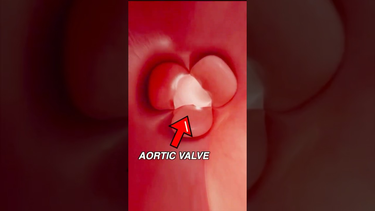 5 clinical signs of aortic regurgitation #usmle #medicalstudent #cardiology #medical #science