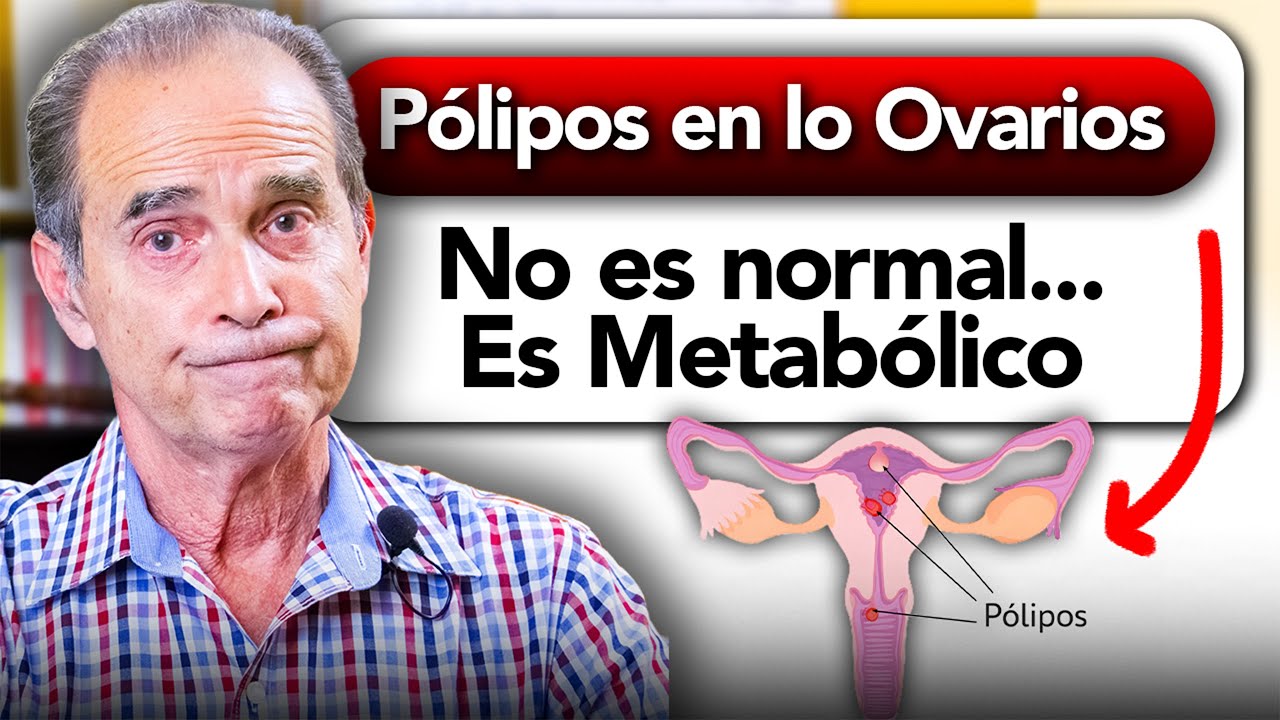 Pólipos en los Ovarios: No es Hormonal… Es Metabólico