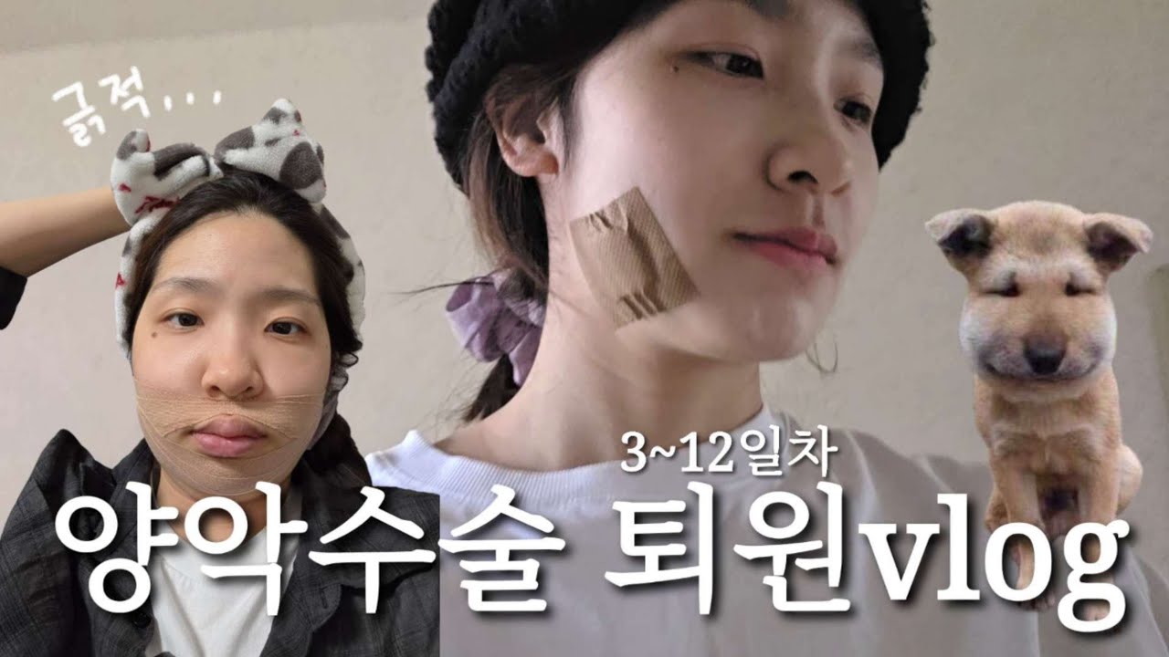 [ENG] 양악수술 퇴원 4~12일차 브이로그 | 수술식단 | 붓기 언제 빠져요?