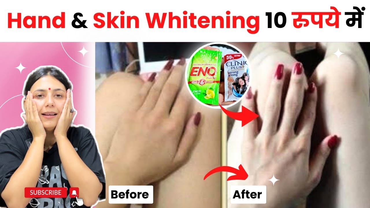 Feet And Hand Brightening Remedy | Pedicure And Manicure At Home | Dr. Upasana Vohra | Tan Removal