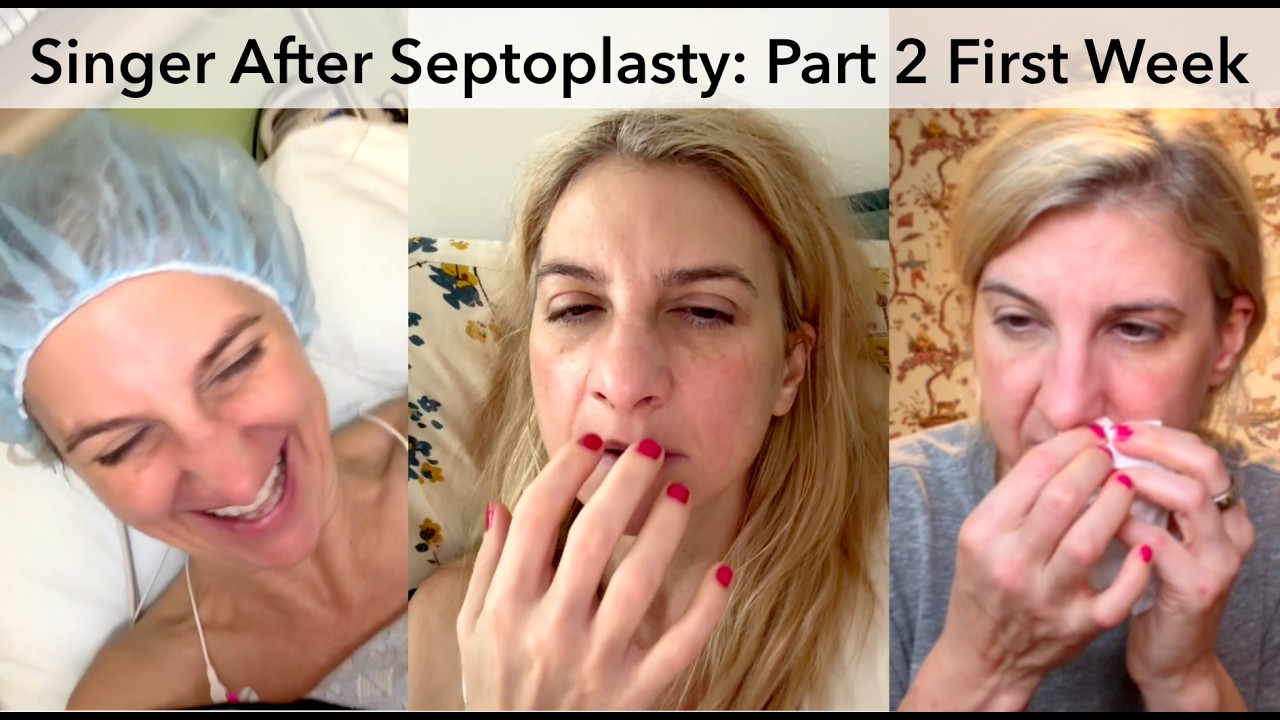 Singer's Septoplasty & Turbinate Reduction - Part 2