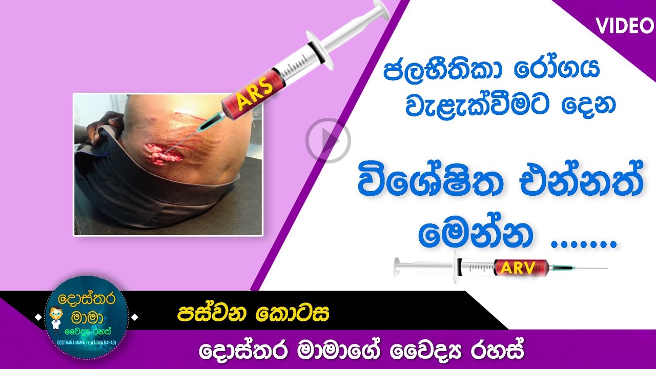 Rabies (Part 5) - ජලභීතිකා රෝගය වැළැක්වීමට දෙන විශේෂිත එන්නත් මෙන්න...( 05 කොටස )