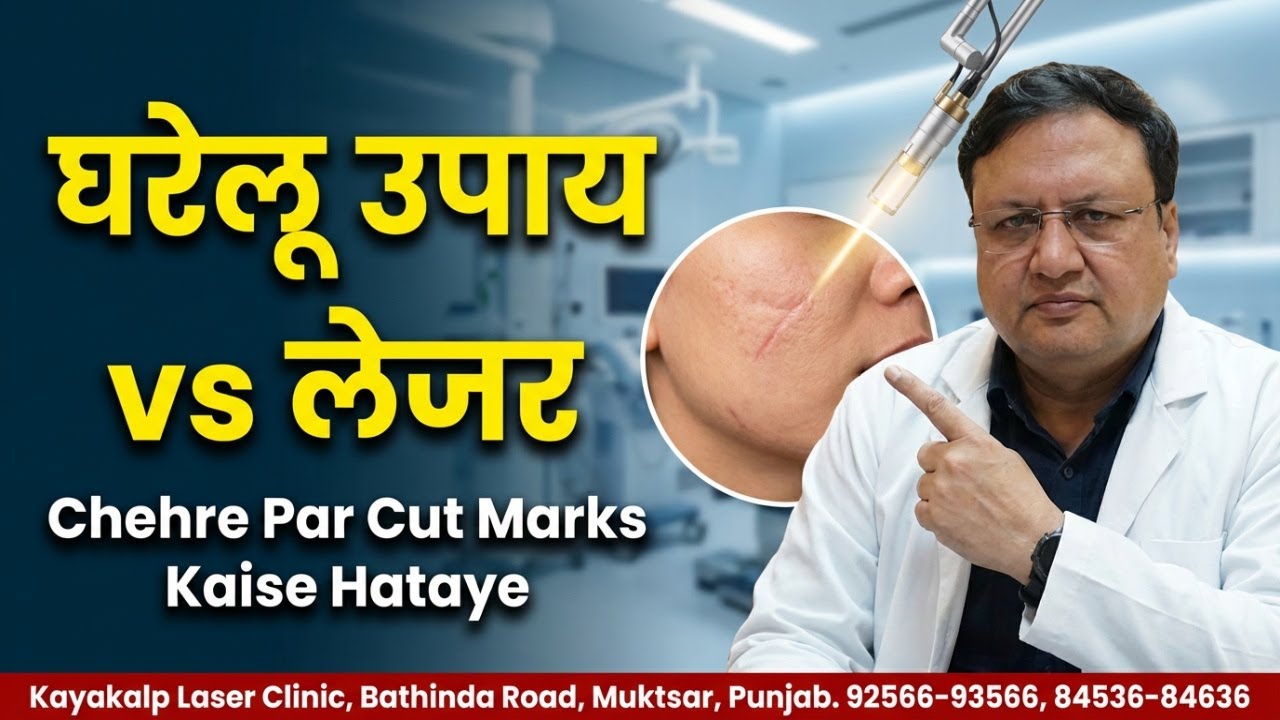 घरेलू उपाय या लेजर ट्रीटमेंट – क्या है बेहतर? Chehre Par Cut Marks Kaise Hataye