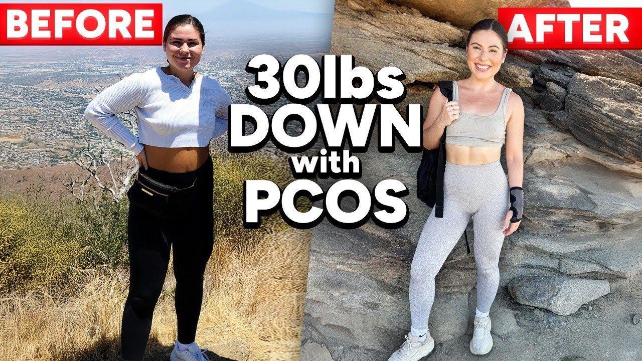 My PCOS Journey (Symptoms, Diagnosis, and Weight Loss)