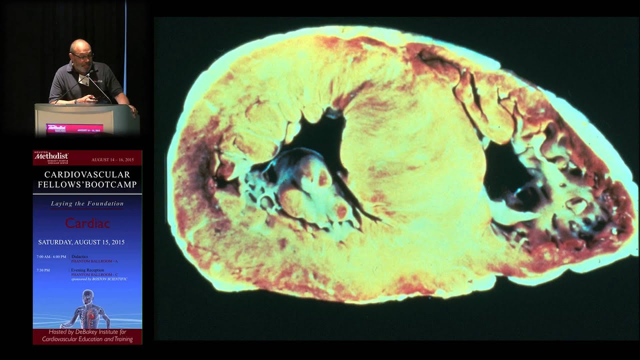 Syncope (J.B. Durand, MD)