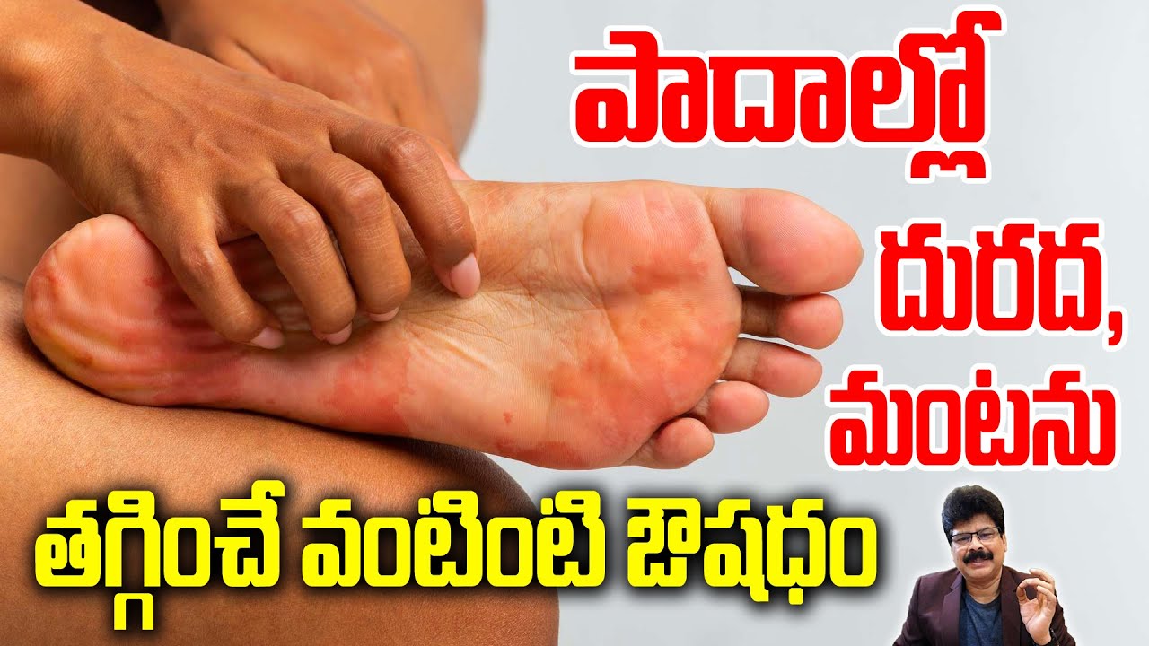 పాదాల్లో దురద, మంటను తగ్గించే వంటింటి ఔషదం! Itchy Feet?? Home remedies for U! Dr. Murali Manohar