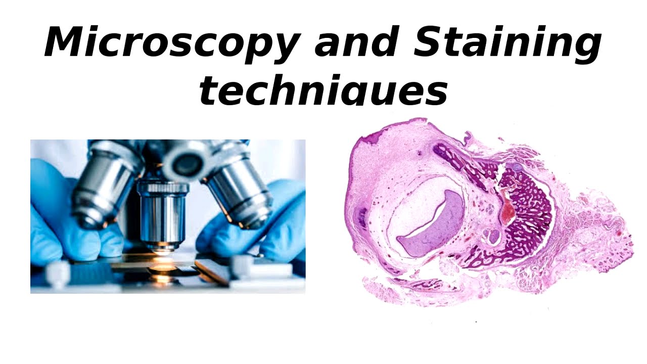 Microscopy and Staining Techniques