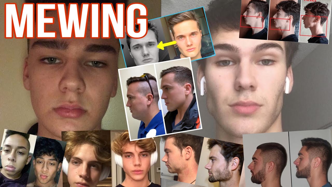 MEWING e HARD MEWING: La Guida Definitiva