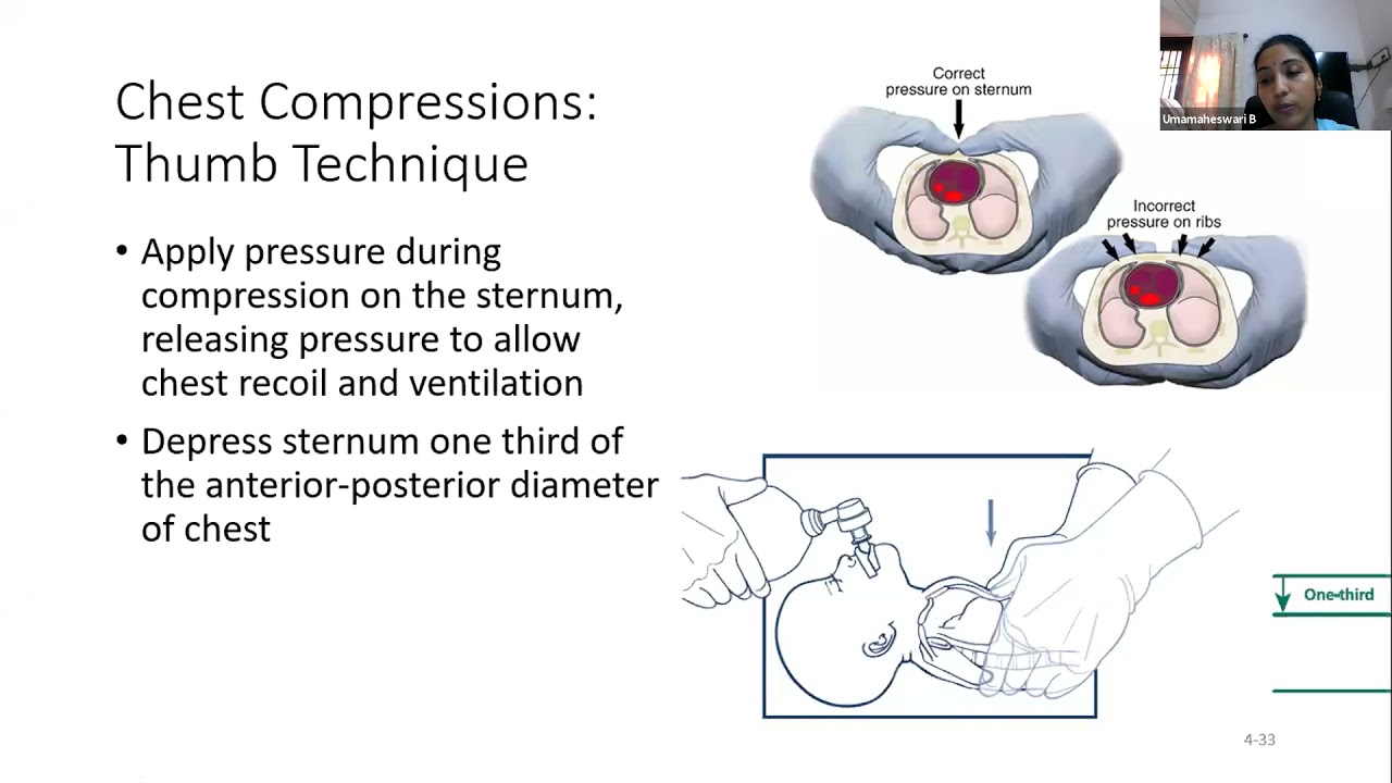 4. Advanced NRP - Algorithm beyond positive pressure ventilation - Dr. B. Uma Maheswari