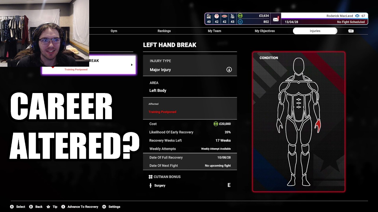 He Punched Too Hard and Broke His Hand - Undisputed